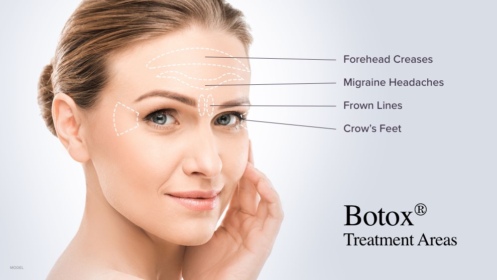 Botox Treatment Areas
