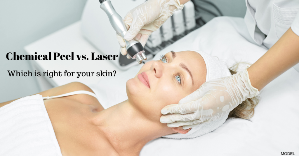 chemical peel vs. laser. Which is right for you?